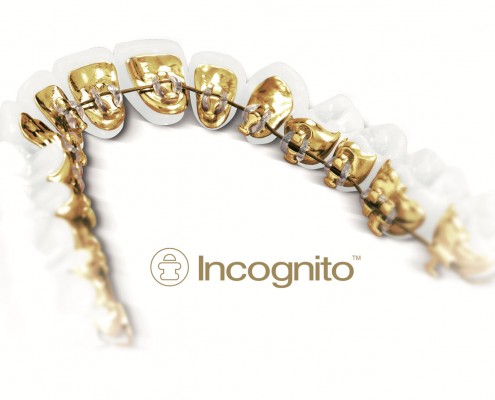 Incognito_appliance-2